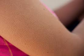 Goosebumps Science