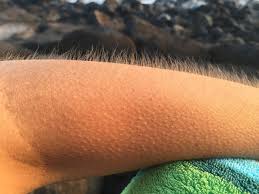 Goosebumps Science